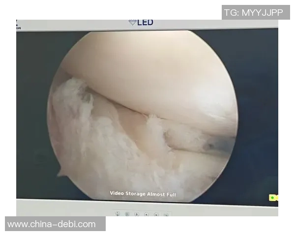 罗威再度受伤接受左膝关节镜手术预计缺席四周球队面临困境